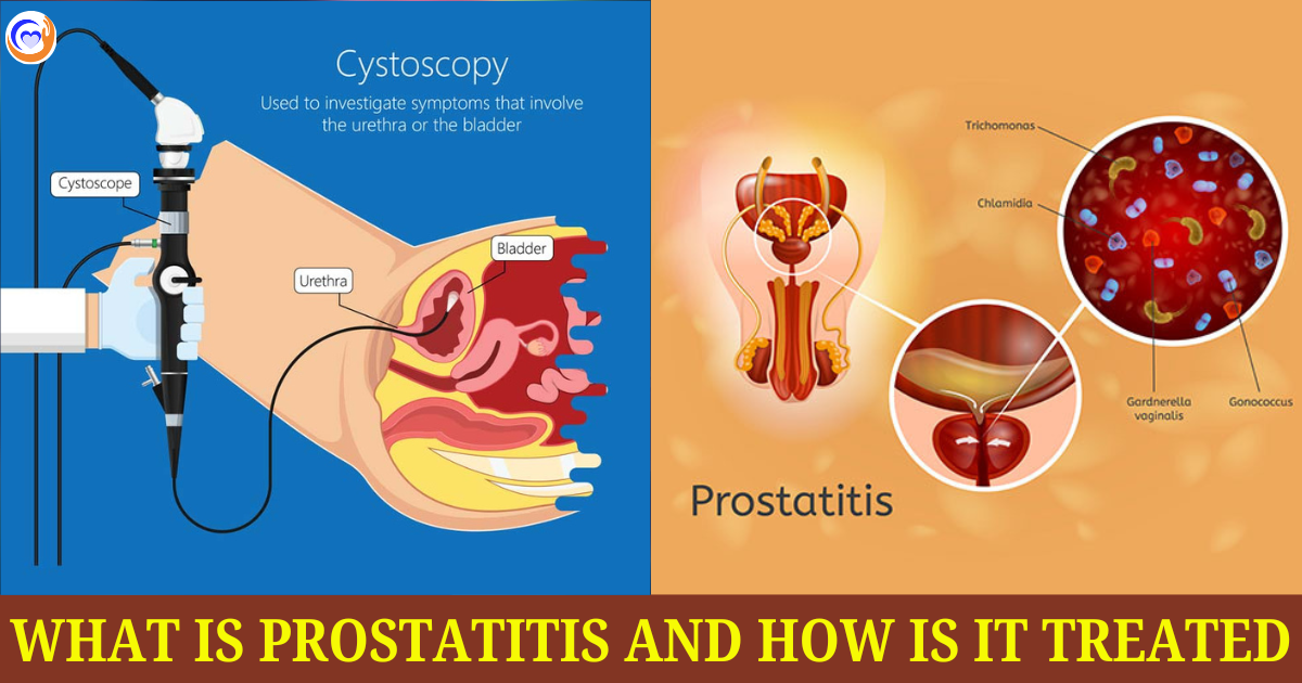 What is Prostatitis and How is It Treated